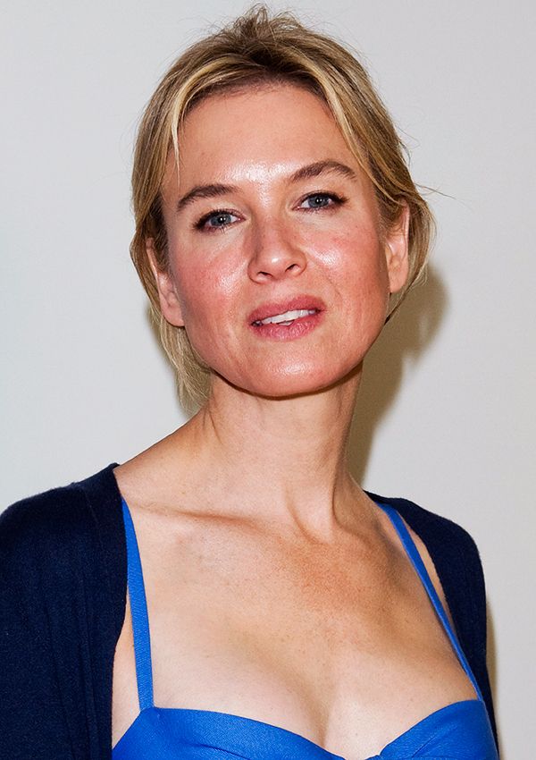 rosacea come curarla